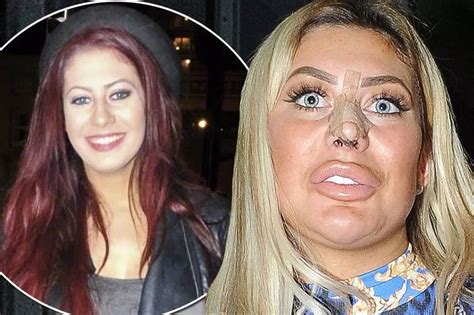 chloe ferry bum surgery